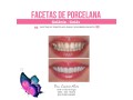 facetas-porcelana-goiania-goias-small-3