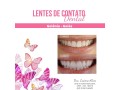 facetas-porcelana-goiania-goias-small-2
