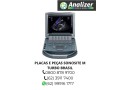 assistencia-tecnica-especializada-sonosite-small-3